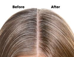 L'Oréal pro product picture